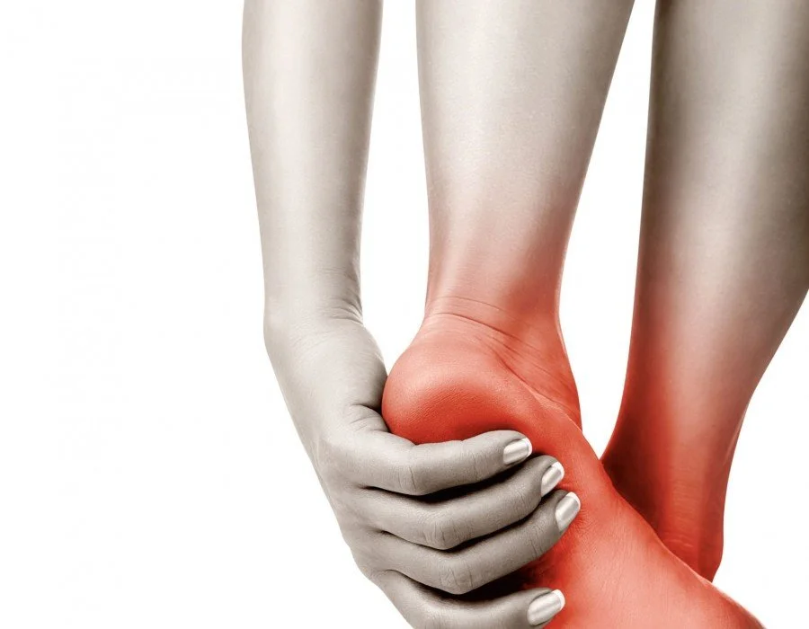 Plantar Fasciitis